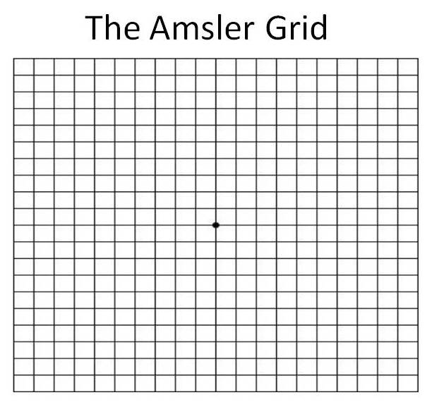 The Amsler Grid For Macular Degeneration - Millennium Eye Center